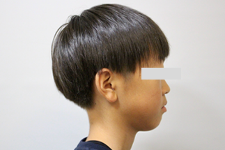 After